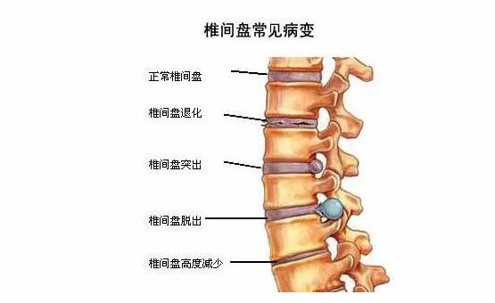 膏药加盟